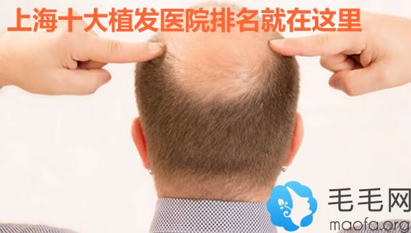 上海十大植发医院排名表